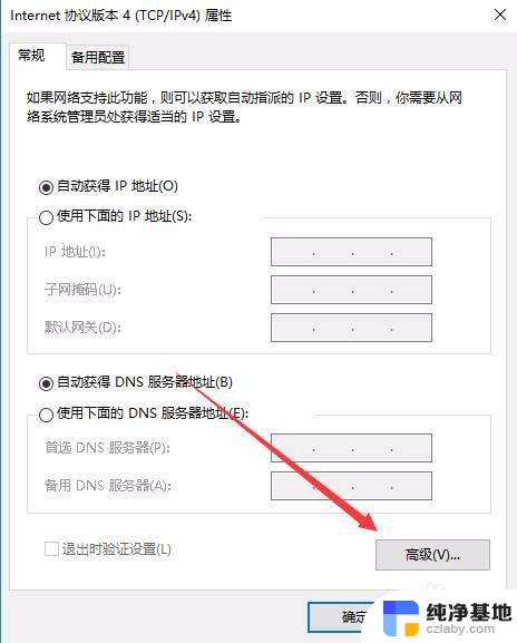 启用tcp/ip上的netbios怎么设置